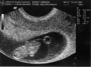 The first picture...